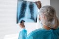 Почти у 300 амурчан с начала года диагнозирован туберкулез. Фото: freepik.com