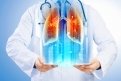 Туберкулез на ранних стадиях можно выявить путем  флюорографического обследования (shutterstock.com)