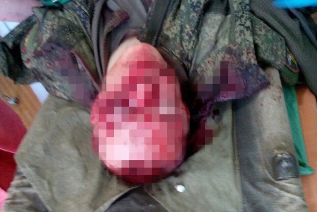В Приамурье проверяют обстоятельства ранения солдата-срочника В Приамурье проверяют обстоятельства ранения солдата-срочника