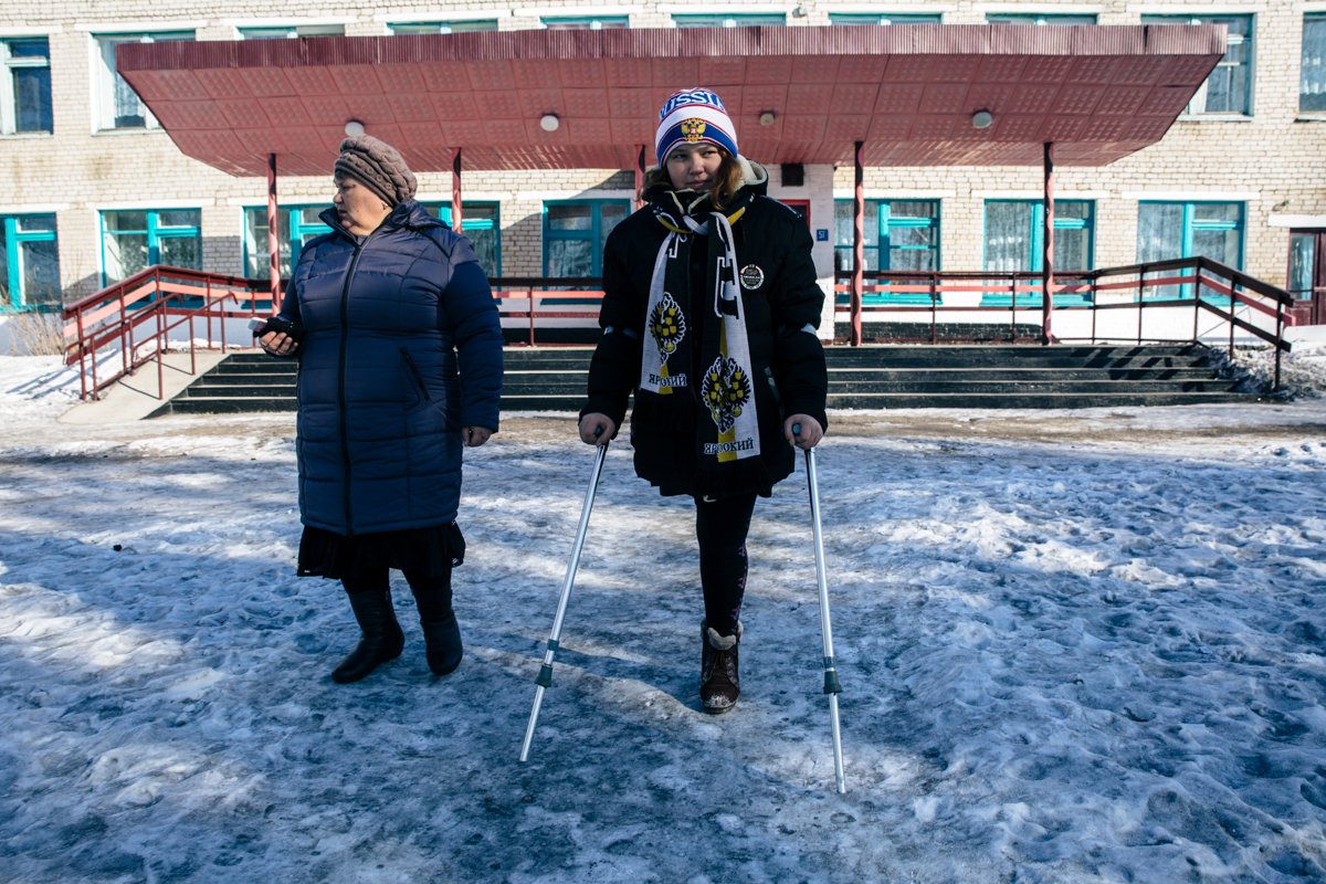 С чем связано выпадение волос на голове у женщин