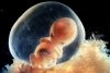 Как выявить врожденную патологию ребенка: советы врача-генетика