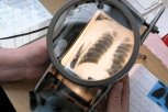Прибор для ранней диагностики болезней легких и астмы разработали амурские ученые